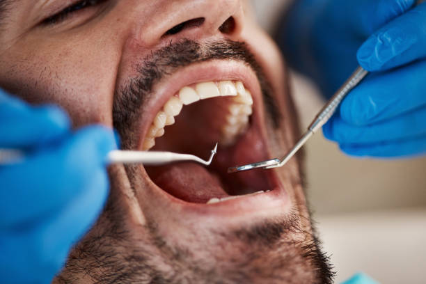 Professional Emergency Dentist in NM